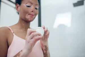 Le vitiligo: tout savoir sur cette maladie qui dépigmente la peau